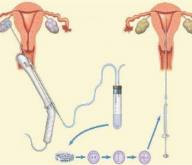 35岁女性备孕请做好以下检查，“健康石家庄代生宝宝”跑不远